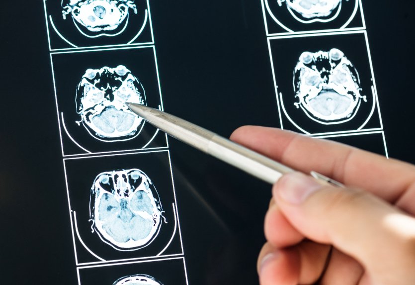 Head Disability Child Head Injury Claims - What You Need To Know - Child Disability